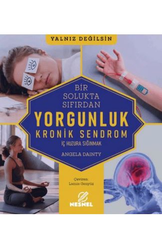 Kronik Sendrom Yorgunluk